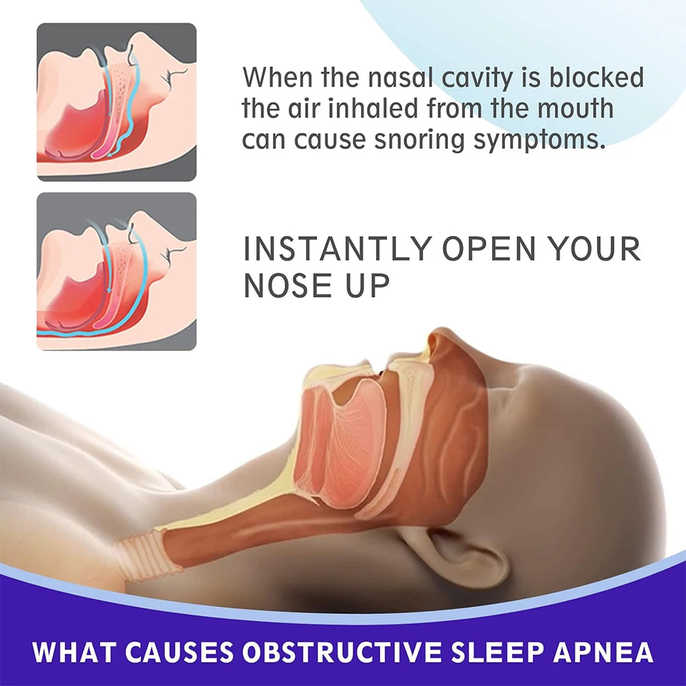 Lunair Snore-Free Nasal Strips